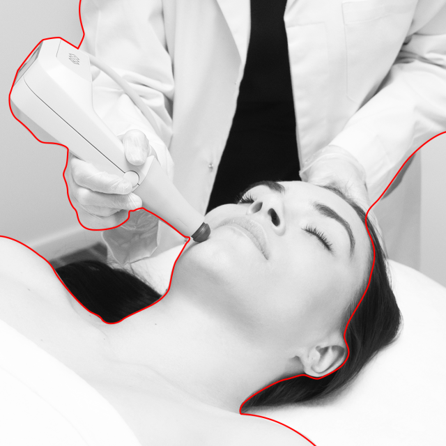 Transformative skin-tightening treatment