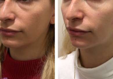 White swan aesthetics results.